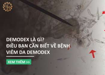 Demodex là gì? Điều bạn cần biết về bệnh viêm da Demodex