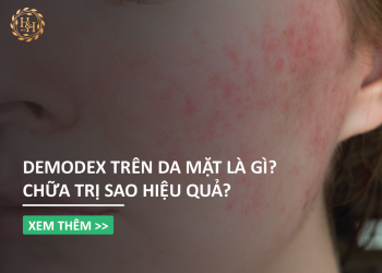 Đối tượng nào hay mắc phải Demodex? Chữa trị sao?